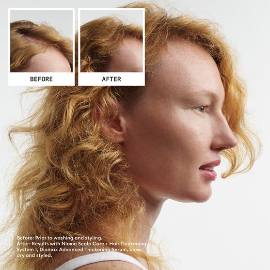 Nioxin Scalp + Hair Thickening System 1 | For Natural or Untreated Hair with Light Thinning | With Niacinamide and Biotin | Trial Size | 1 Month Supply