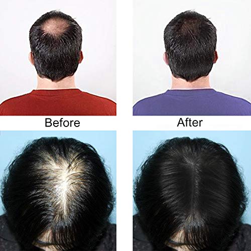 Hair Fibers Hair Building Fibers 100% Undetectable Hair Fuller Thicker,Instantly Cover Sparse Hair 25g/0.88oz (midgold)