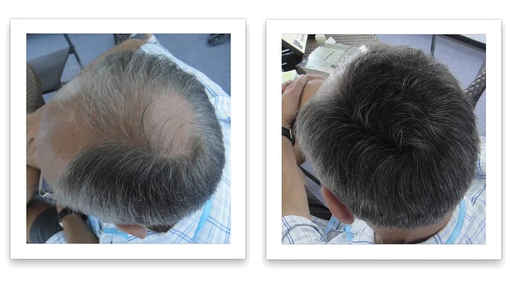 Caboki Hair Loss Concealer, 90-day supply, Dark Gray
