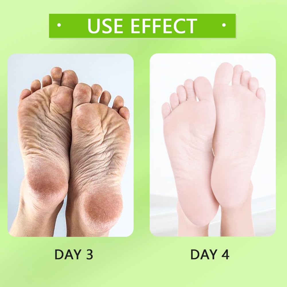 Jelly Pedicure Foot Soak Packets Foot Soak Salts Pedicure Foot Soak For Feet Tired Foot Odor Nail Discoloration Feet Softens Calluses Pedicure Foot Gel (Milk*5)