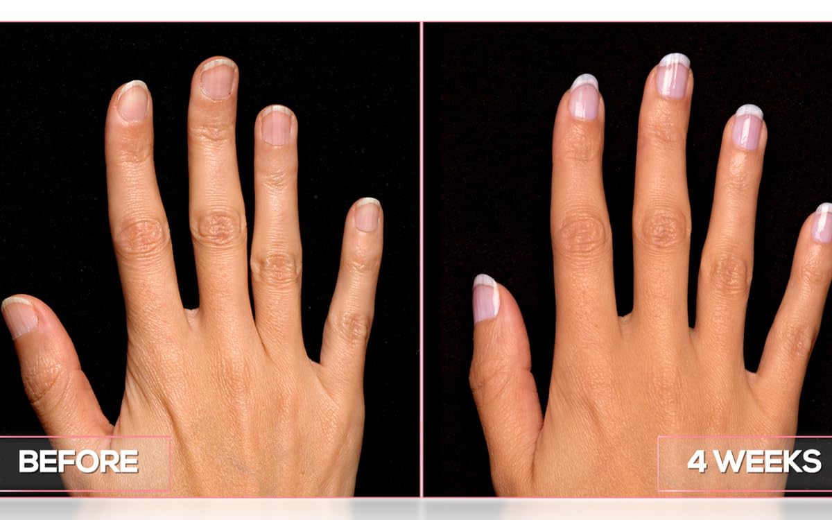 Perfect Formula Pink Gel Coat - Nail Strengthener and Strengthening Polish for Women, Extra Strong Nail Hardener, Keratin Treatment for Damaged Fingernails