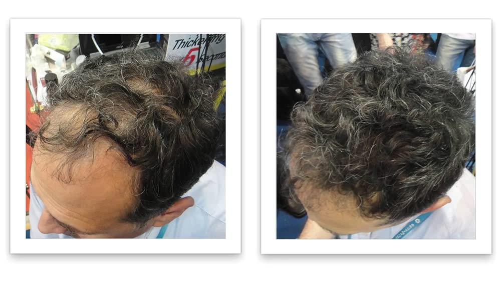 Caboki Hair Loss Concealer (All-Natural Hair Building Fibers) Travel Size. (Salt & Pepper - Dark)