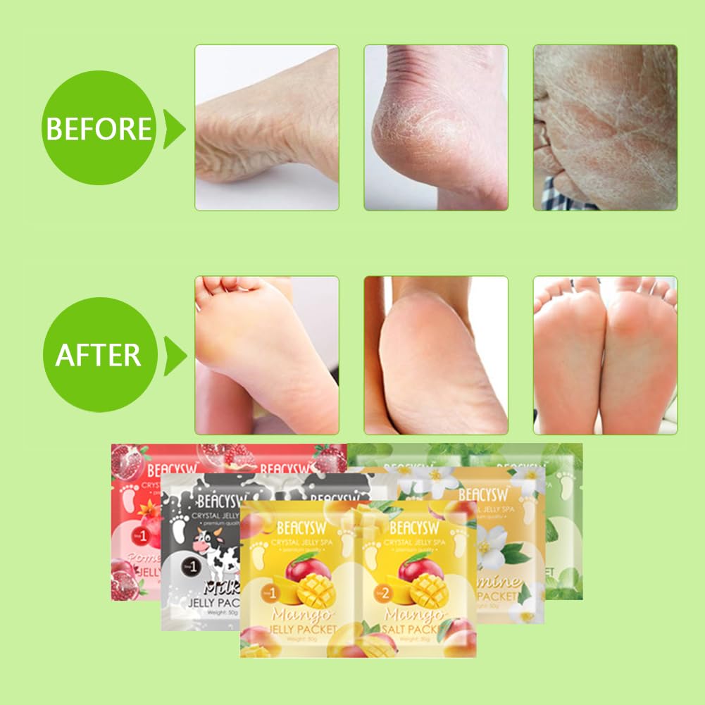 Jelly Pedicure Foot Soak Packets Foot Soak Salts Pedicure Foot Soak For Feet Tired Foot Odor Nail Discoloration Feet Softens Calluses Pedicure Foot Gel (Milk*5)