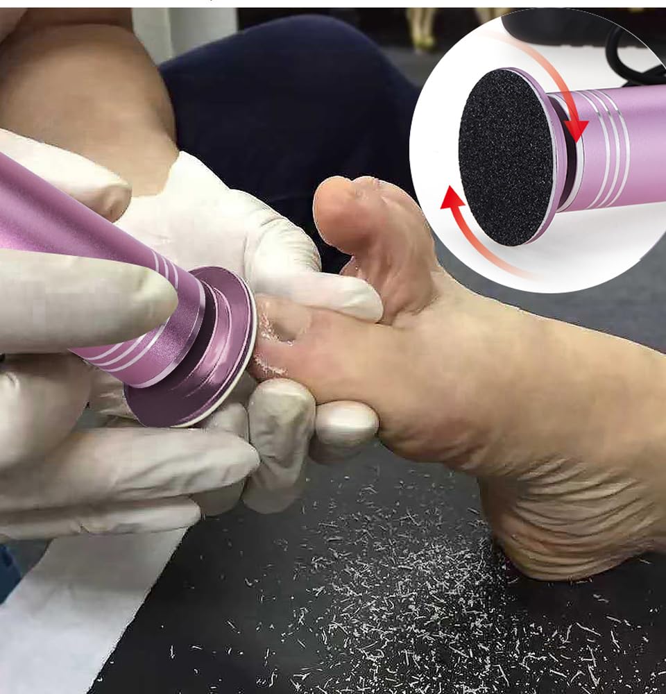 Upgraded Electric Foot Callus Remover, Professional Electric Foot File Sander Pedicure Tools for Feet Dead Skin Cracked Heels, Adjustable Speed, Replaceable Sandpaper Discs (FCR-2 Pink)