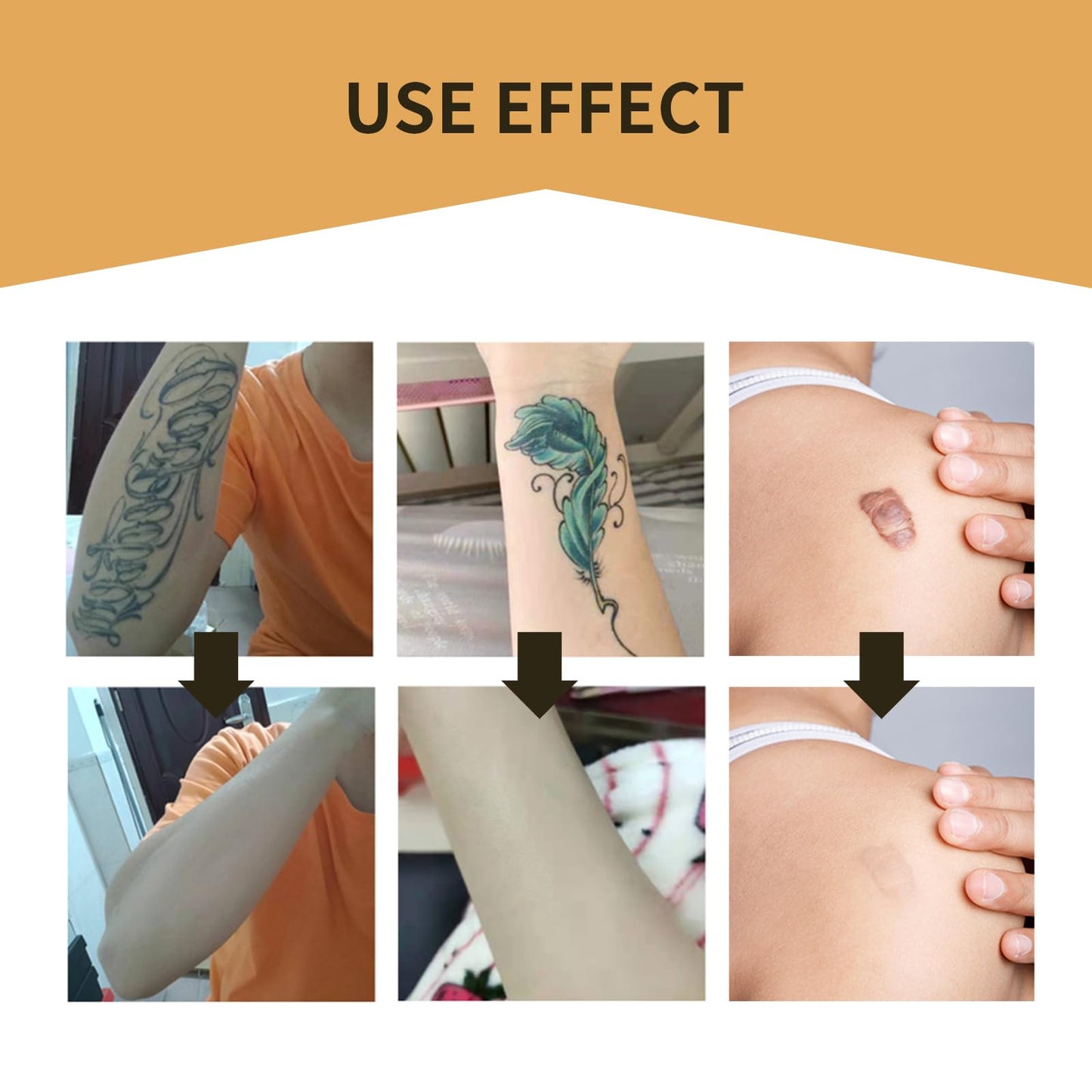 Tattoo Cover Up Tape, 6 PCS Flesh-Colored Ultra Thin Patches for Concealing Tattoos, Scars, Birthmarks, Invisible, Waterproof, and Breathable Makeup Skin Tone Concealer Stickers for Flawless Coverage