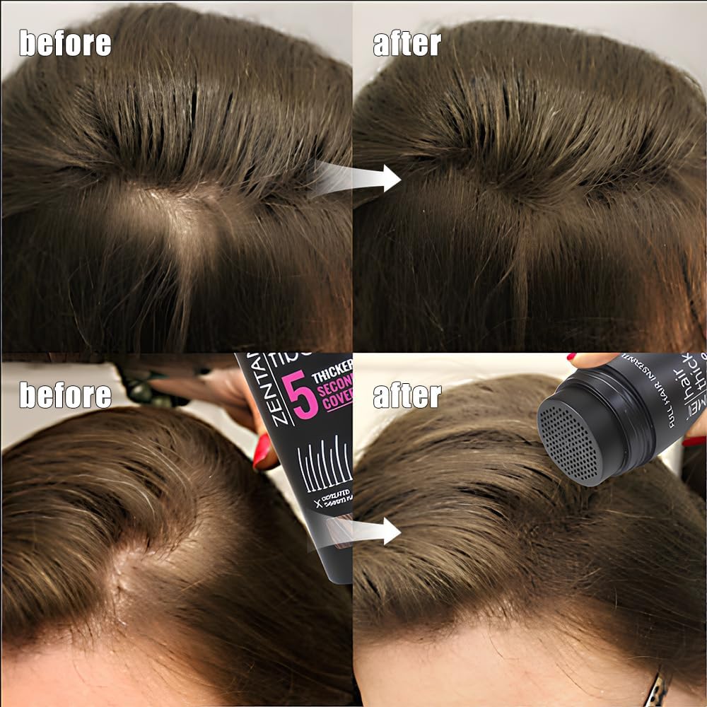 Hair Fibers for Thinning Hair for Women All-Natural Hair Building Fibers 0.98 Oz Hair Volume Powder Bald Spot Cover Up for Men & Women (White)