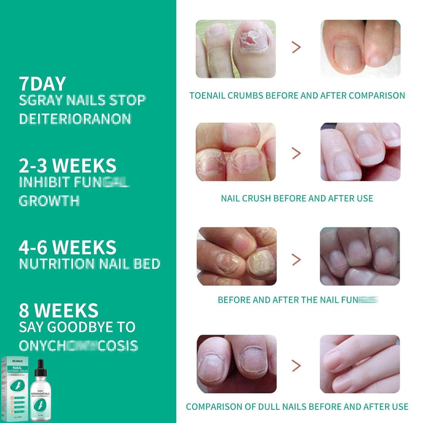 MUBSEOTH Kerassentials Toenail Oil, Kerassentials Nails Nutrient Oil, Nail Repair Solution 30ML/1PCS (4PCS)