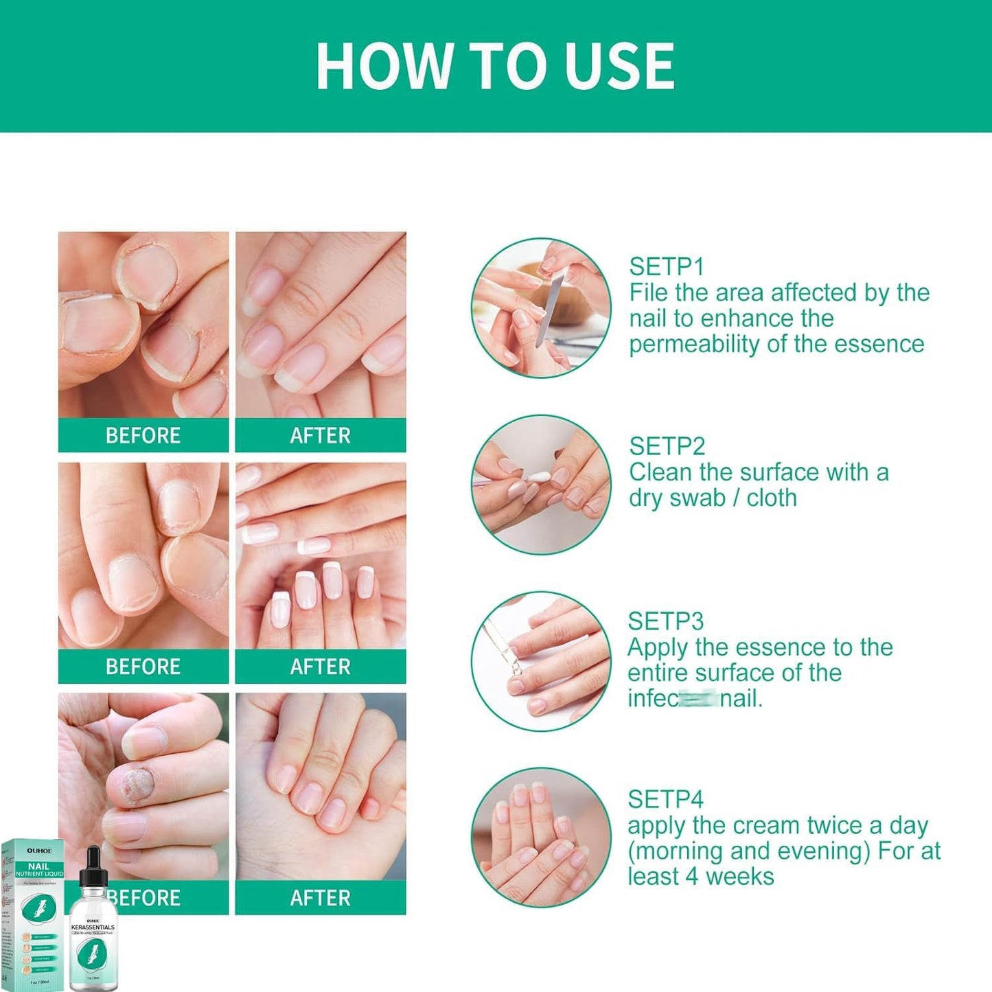 MUBSEOTH Kerassentials Toenail Oil, Kerassentials Nails Nutrient Oil, Nail Repair Solution 30ML/1PCS (4PCS)