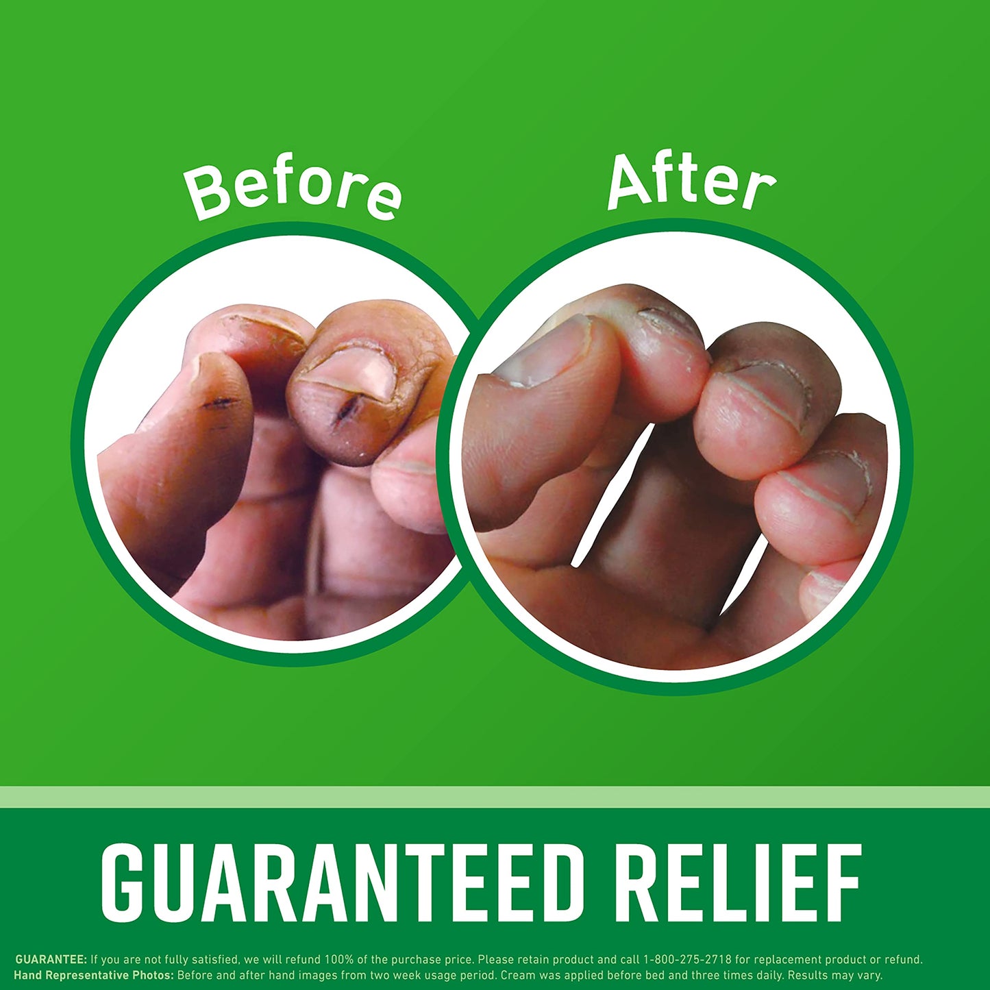 O'Keeffe's Working Hands Hand Cream for Extreme Dryness - 3.4 oz Jar (12 Pack) - Repairing Skincare for Cracked, Dry Hands