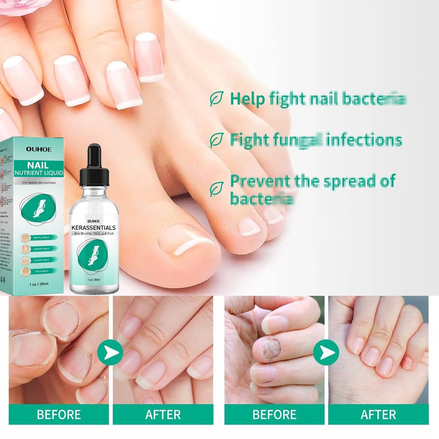 MUBSEOTH Kerassentials Toenail Oil, Kerassentials Nails Nutrient Oil, Nail Repair Solution 30ML/1PCS (4PCS)