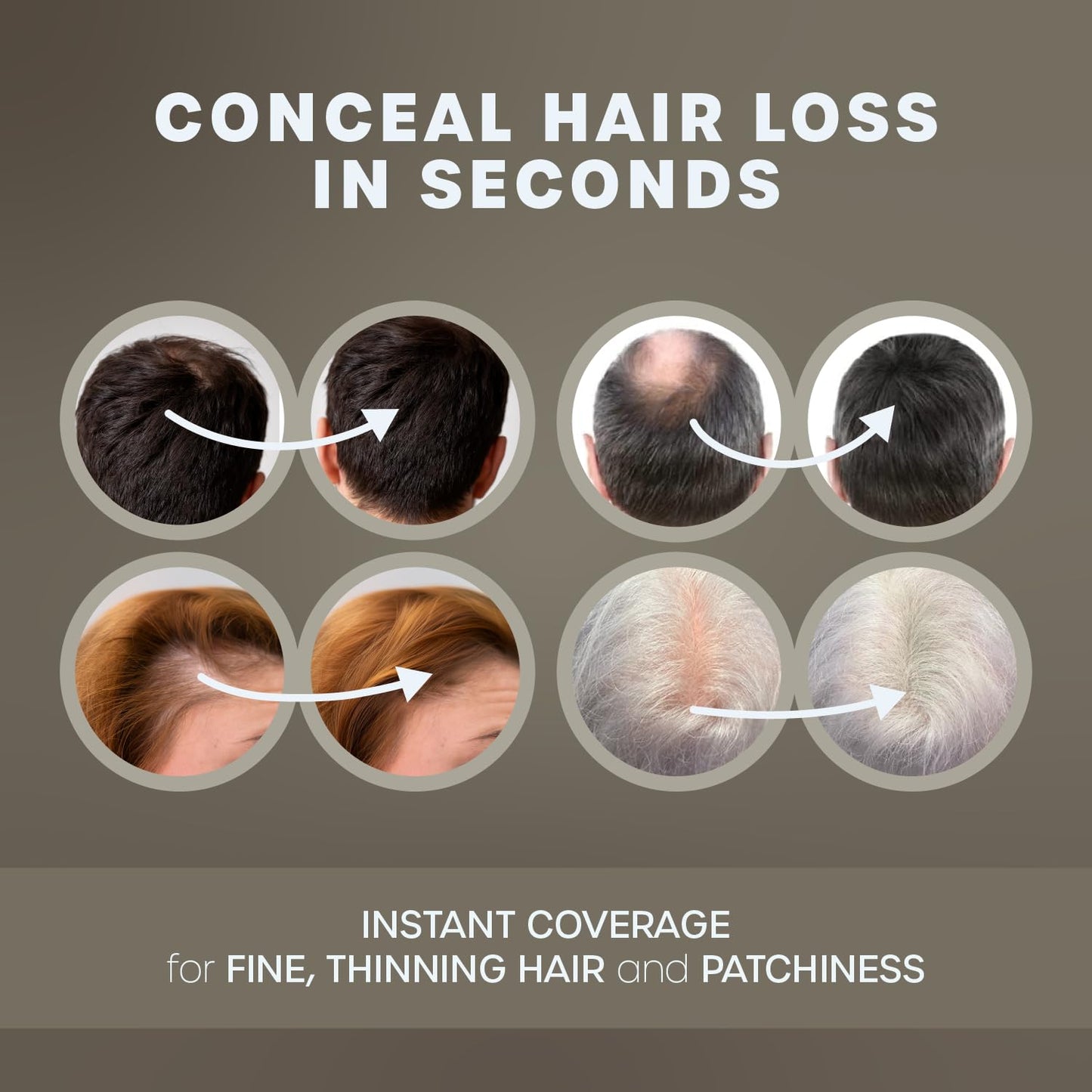 KAAL Hair Fibers for Thinning Hair, Hair Building Fibers (0.97 oz, Medium Brown) - Instantly Conceal Hair Loss in 15 Seconds, 8 Shades for Men and Women