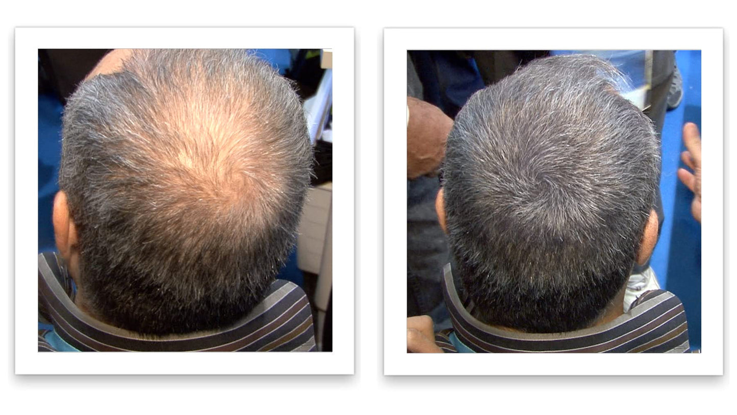 Caboki Hair Loss Concealer (All-Natural Hair Building Fibers) Travel Size. (Salt & Pepper - Dark)