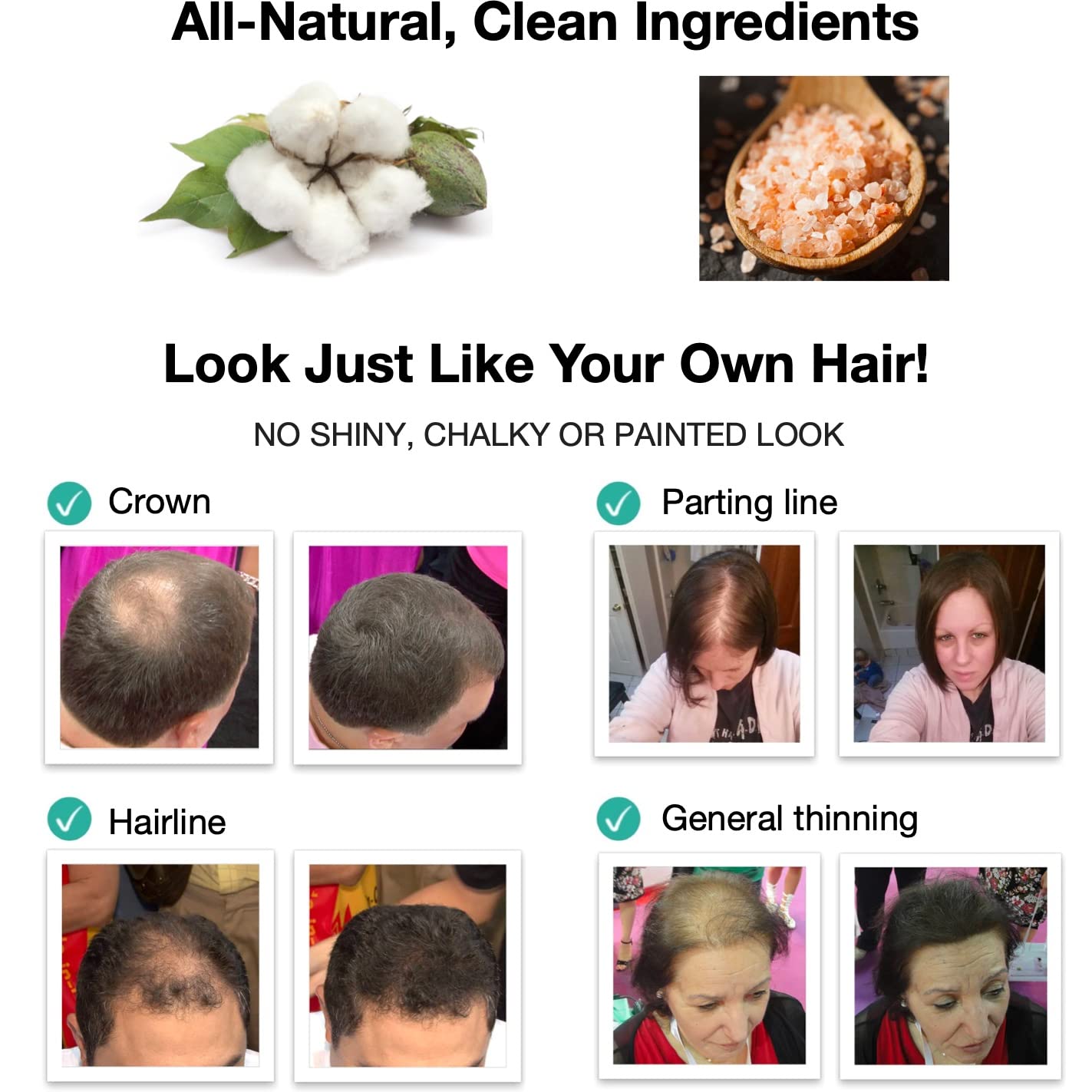Caboki All-Natural, Plant-Based Hair Building Fiber. Hair Loss Concealer. Covers Bald Spot and Thinning Hair. (16G, 40-Day Supply) (Silver/White)