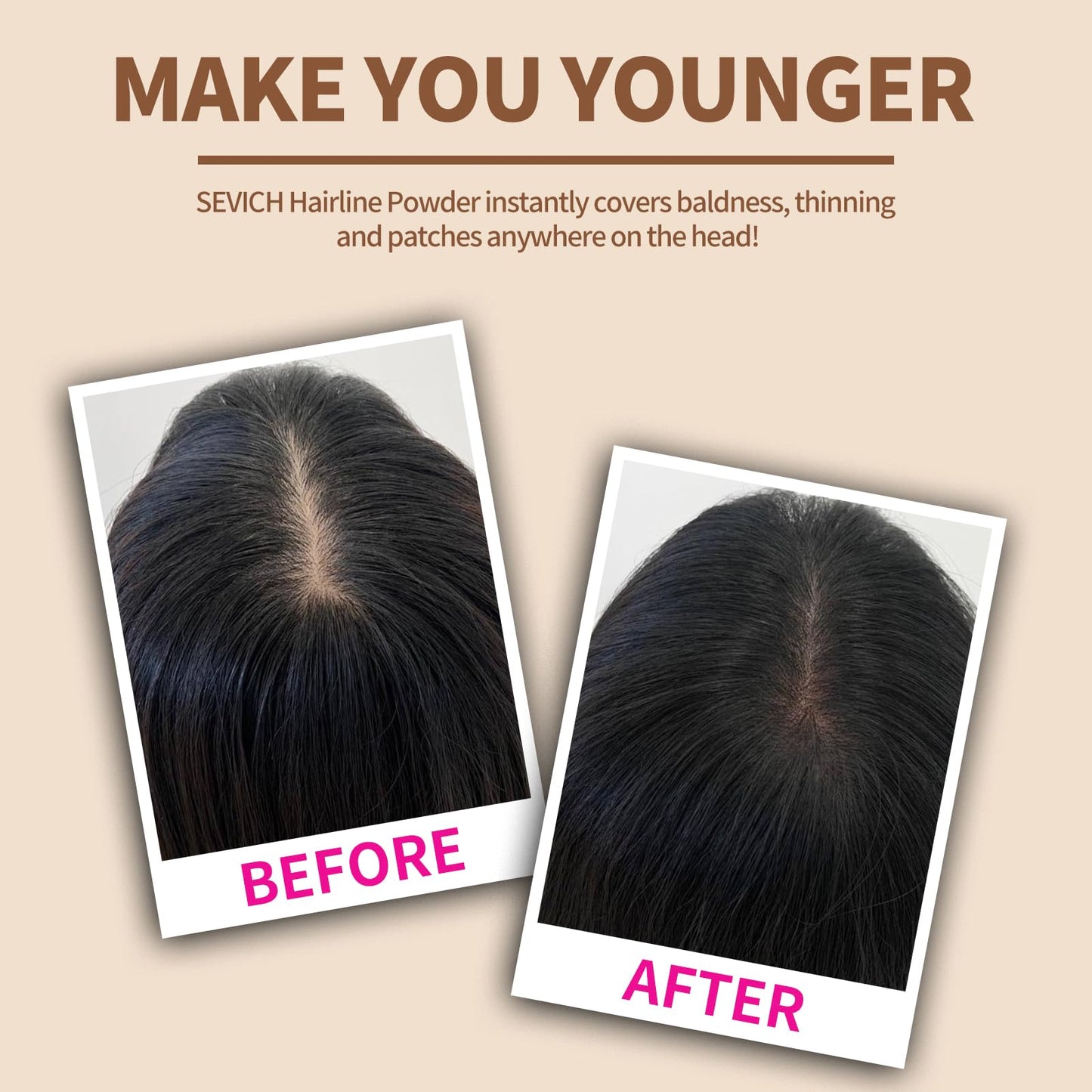 Sevich Hairline Powder: Instantly Conceals Hair Loss and Gray Roots, Grey Windproof & Sweatproof Hair Toppers for Women & Men