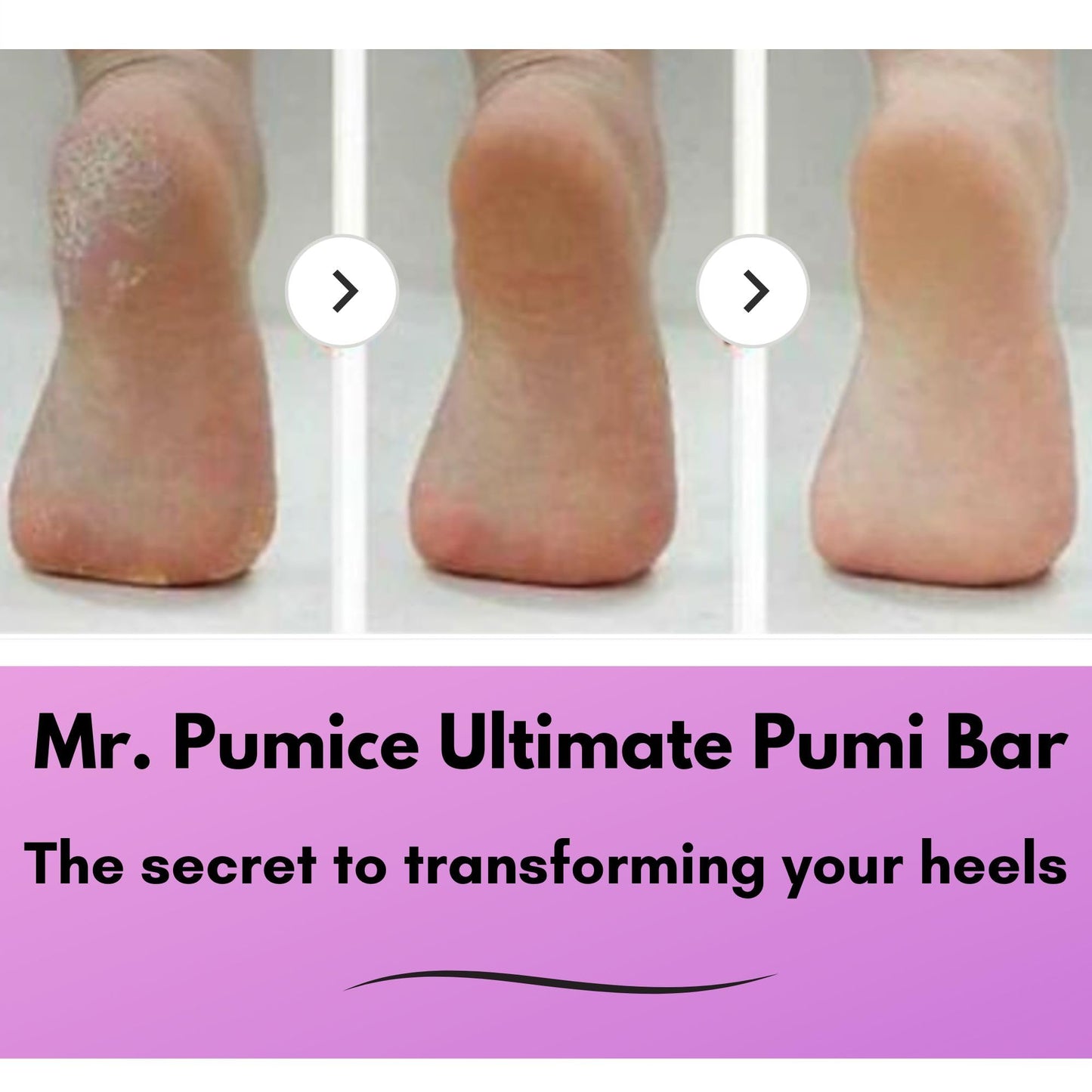 Mr. Pumice Ultimate PUMI Bar: 2-in-1 Dual-Grit (Medium + Coarse) Callus Remover, Pedicure Stone & Ped File Scrubber for Smooth Feet and Heels, (12-Count Display Box)