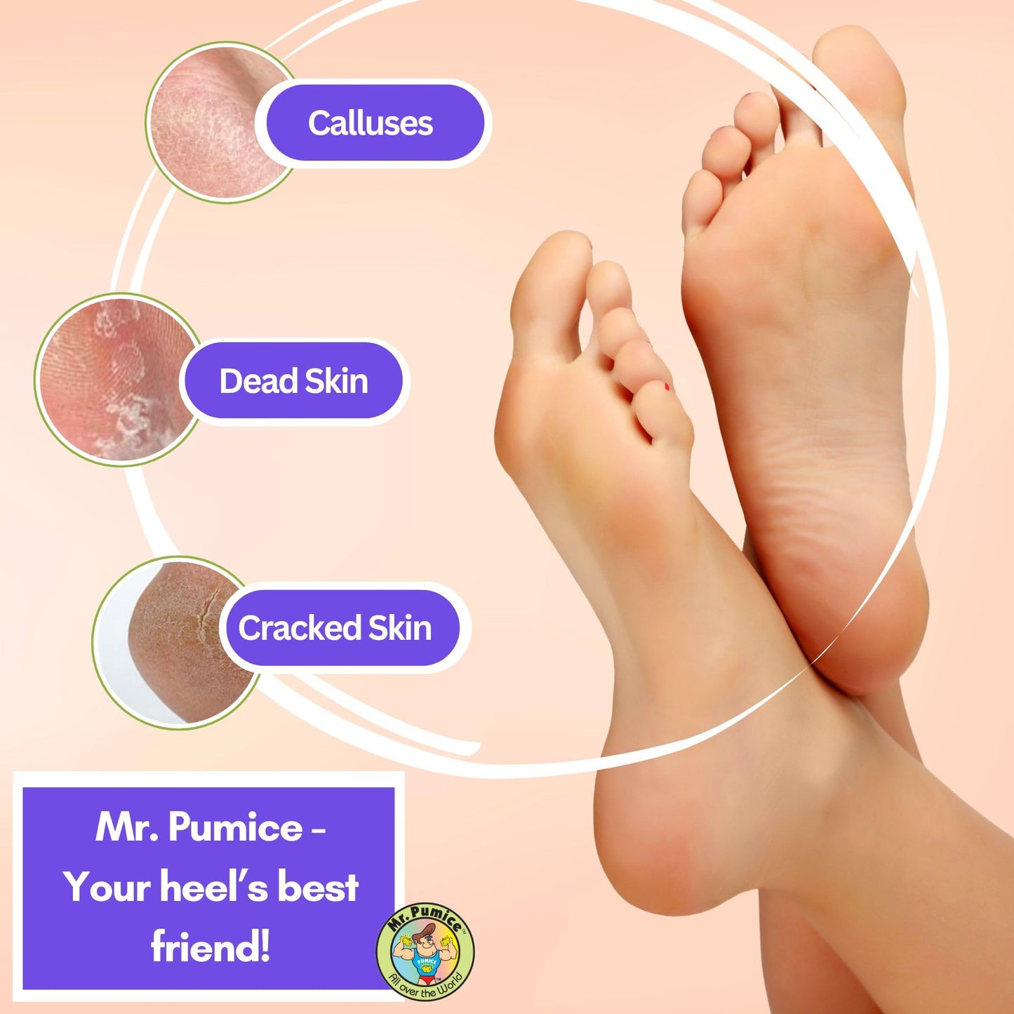 Mr. Pumice Ultimate PUMI Bar: 2-in-1 Dual-Grit (Medium + Coarse) Callus Remover, Pedicure Stone & Ped File Scrubber for Smooth Feet and Heels, (12-Count Display Box)
