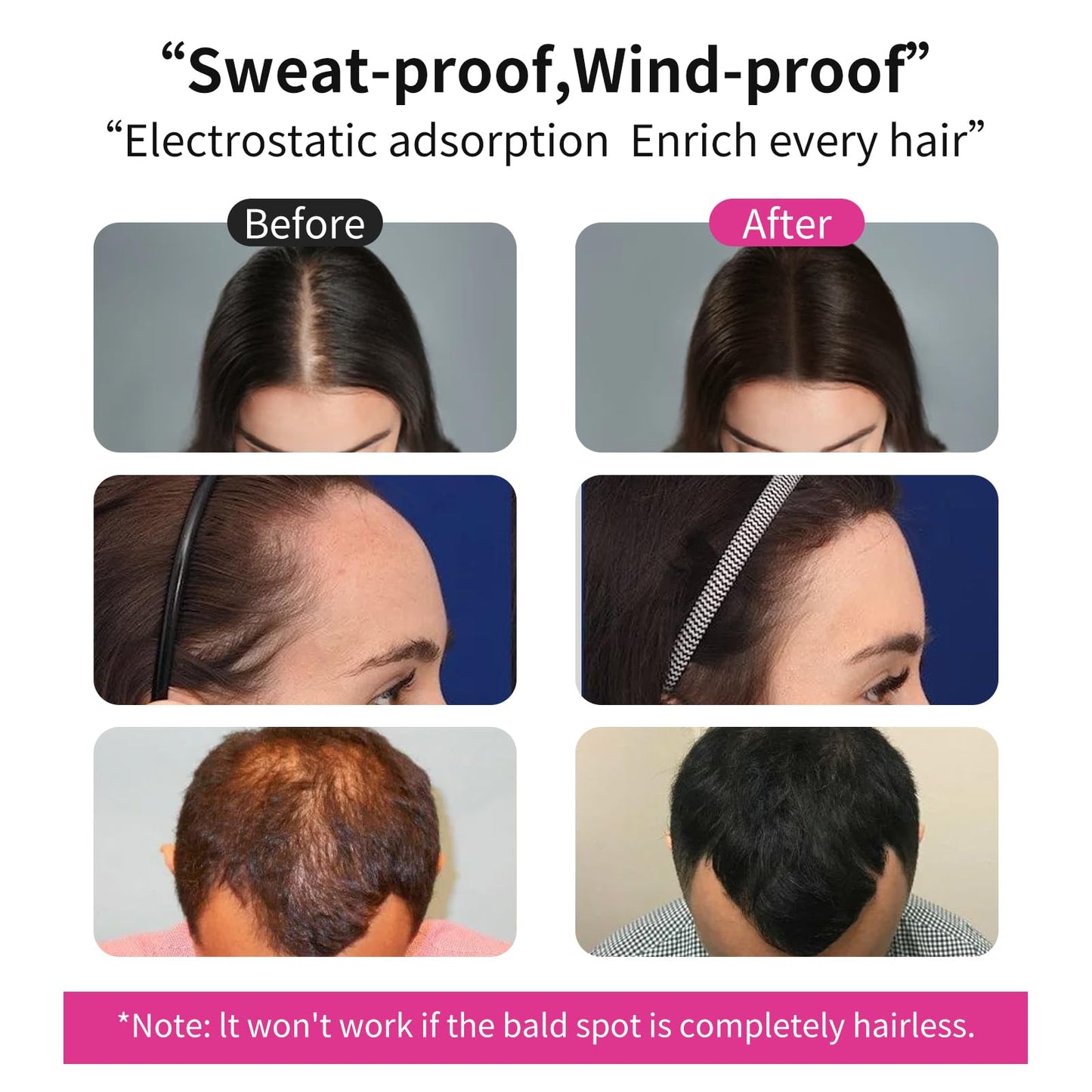SEVICH Hair Fibers Refill 100g - Compatible with Most Brand Bottles | Hair Building Fibers for Thinning Hair | Instant Thickening Powder for Men & Women | 5-Second Natural Coverage,Dark Brown