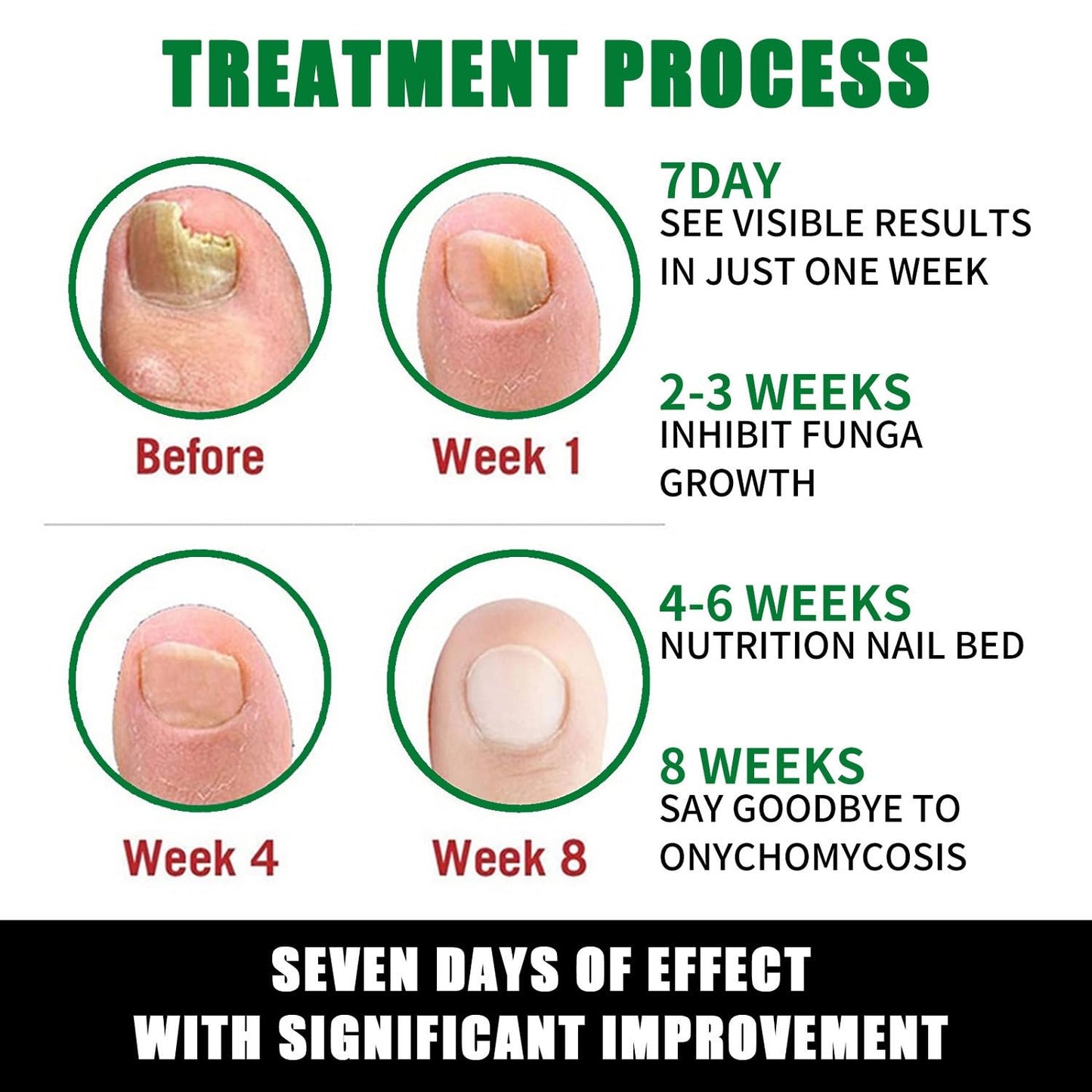 3Pcs Ginger Nail Treatment,7days Nail Treatment,Nail Growth Serum,Ginger Nail Treatment Nail Support Nail Care, Ginger Cuticle Care Oil for Nails Strengthener Oil(30ml)