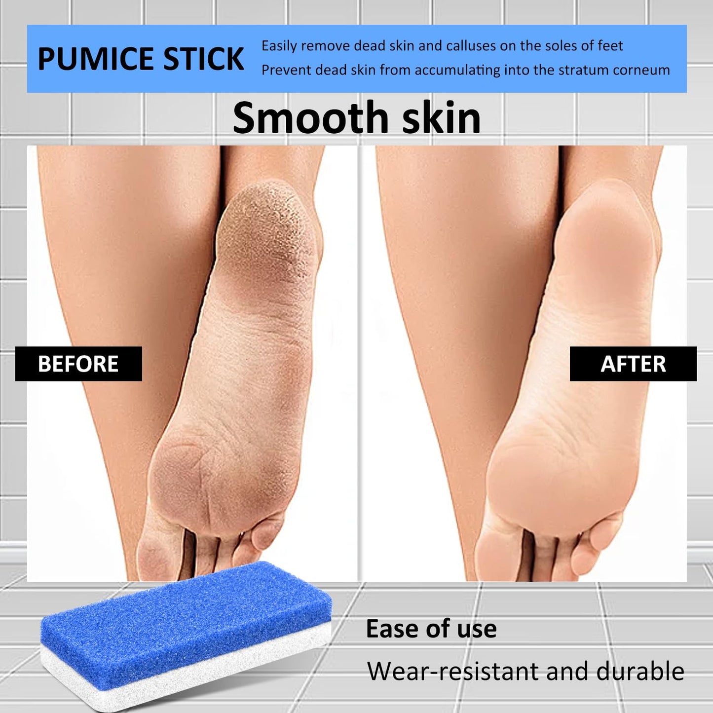 8 Pack Pedicure Foot Pumice Stone for Feet Hard Skin Callus Remover and Scrubber