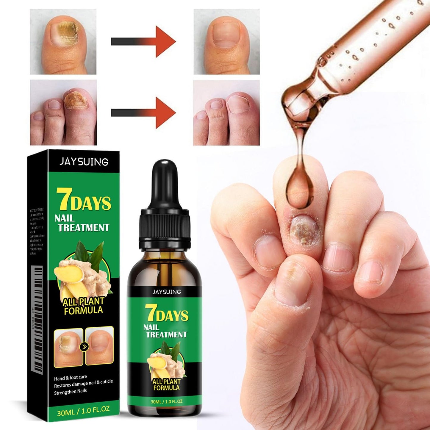 3Pcs Ginger Nail Treatment,7days Nail Treatment,Nail Growth Serum,Ginger Nail Treatment Nail Support Nail Care, Ginger Cuticle Care Oil for Nails Strengthener Oil(30ml)