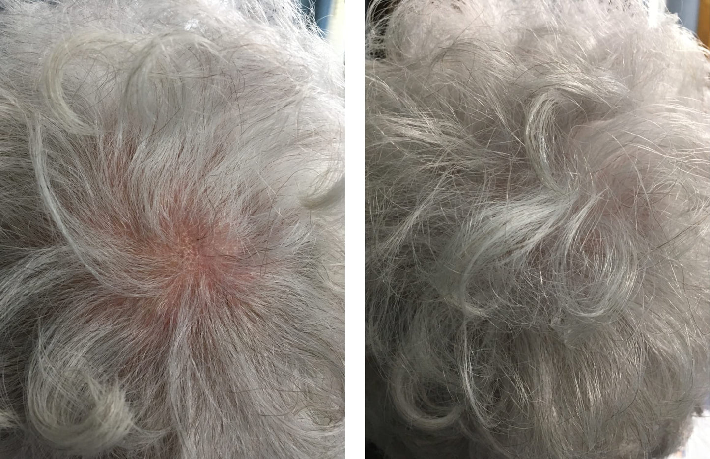 Caboki All-Natural, Plant-Based Hair Building Fiber. Hair Loss Concealer. Covers Bald Spot and Thinning Hair. (16G, 40-Day Supply) (Silver/White)