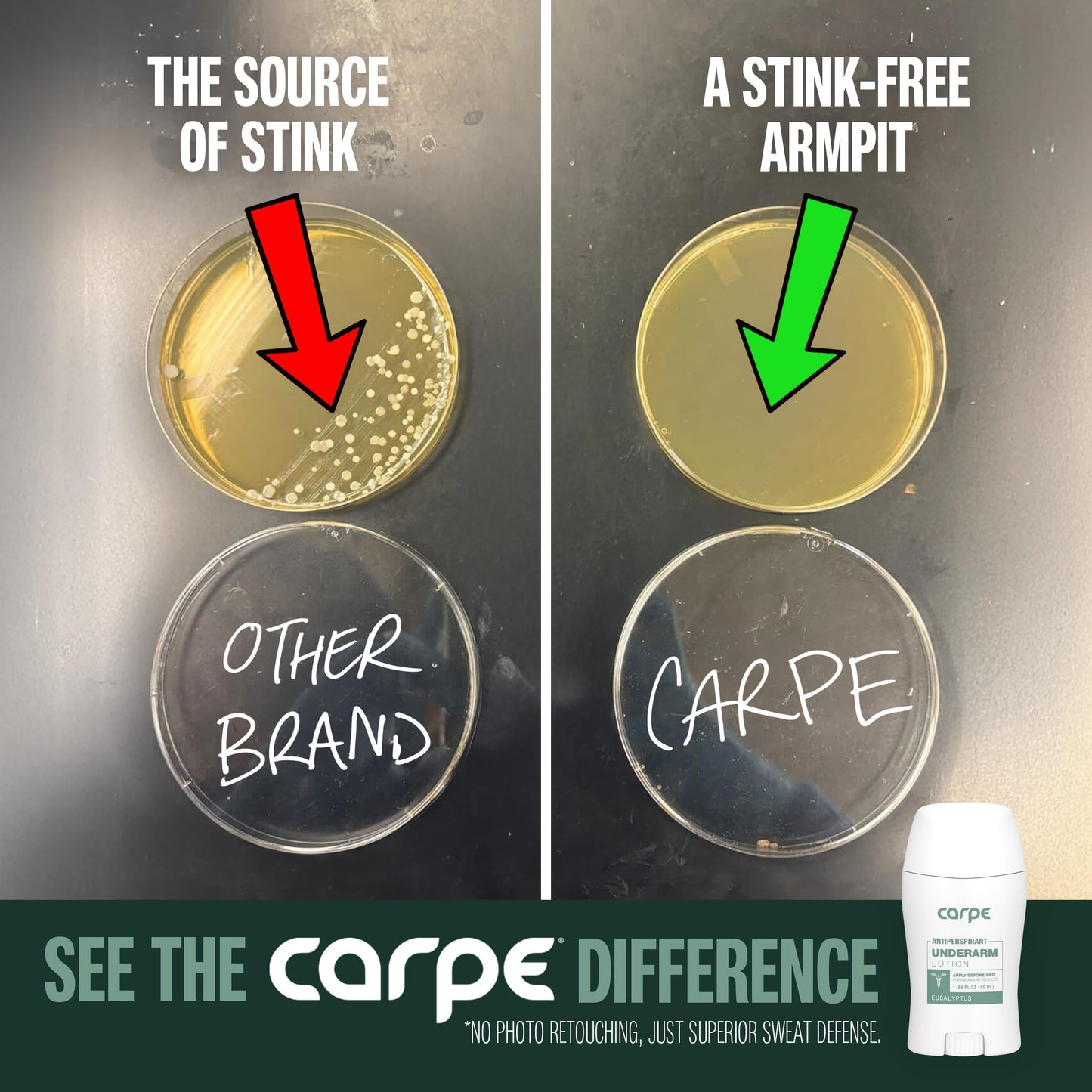 Carpe Underarm Antiperspirant and Deodorant, Clinical strength antiperspirant with all-natural eucalyptus scent, Combat excessive sweating and stay fresh. Great for hyperhidrosis (Pack of 2)