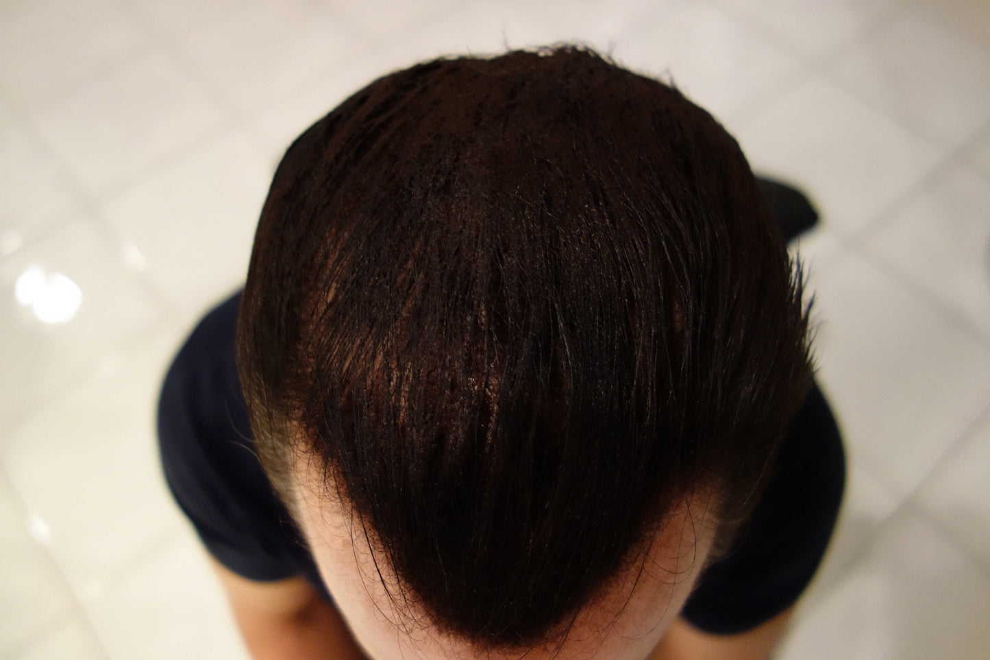 Finally Hair Keratin Hair Building Fibers for Hair Thickening Fiber Hair Loss Concealer. (Dark Grey & Pepper)
