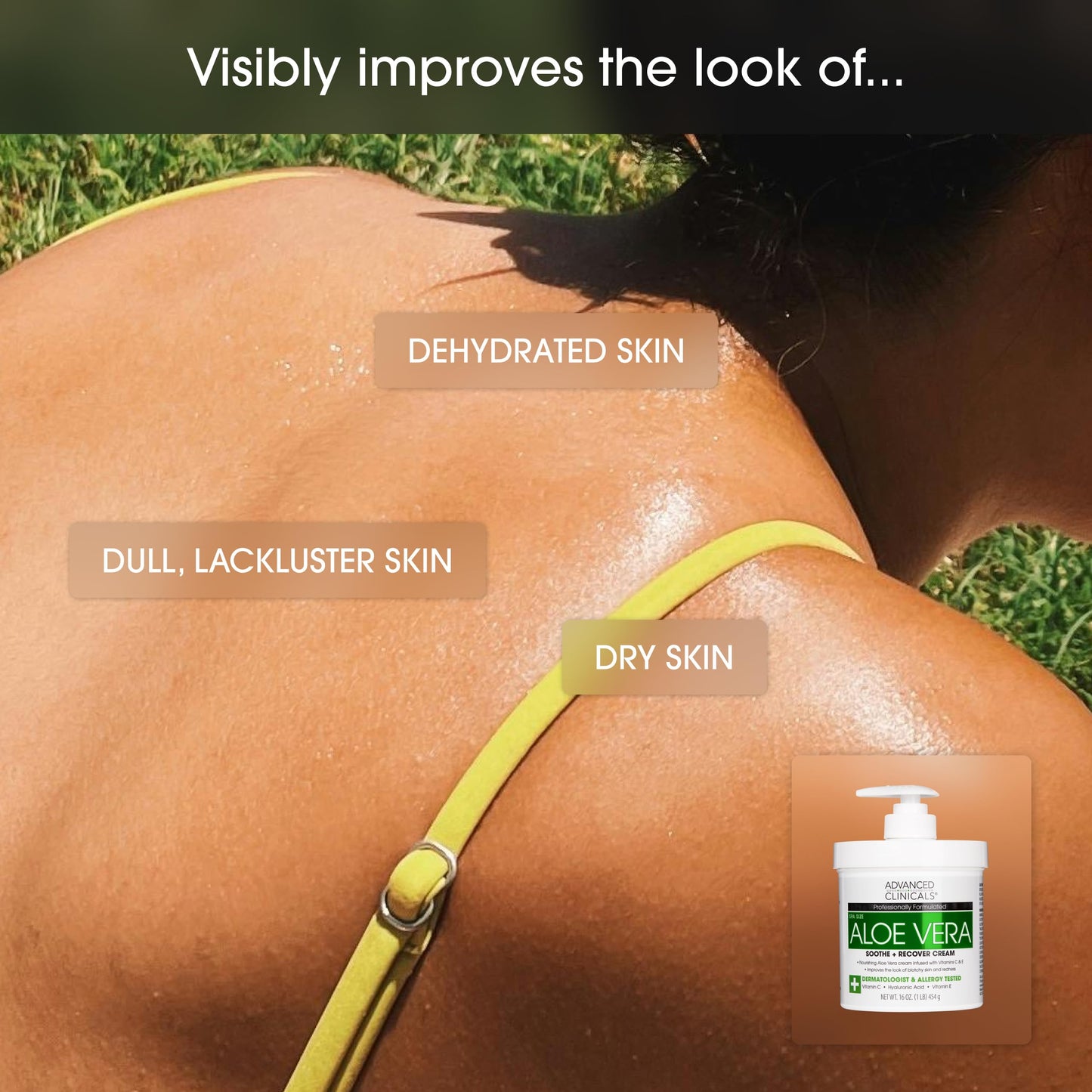 Advanced Clinicals Aloe Vera Lotion Sun Burn Recovery Cream | After Sun Body Lotion W/Vitamin C + Hyaluronic Acid | Sun Damaged Skin Repair Moisturizing Cream | Skin Care Products, Large 16 Oz, 2PC
