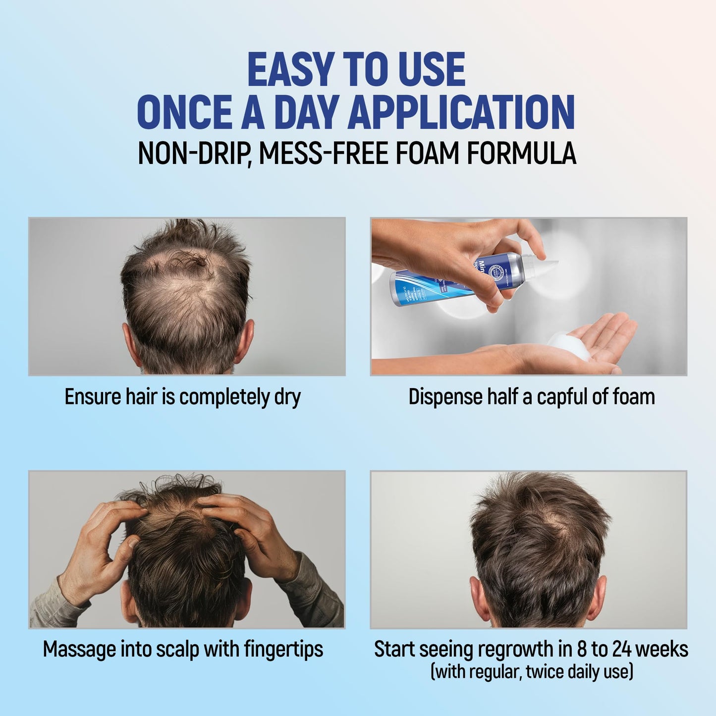 Taro Minoxidil Topical Aerosol Foam, 5%, Hair Regrowth 2 Months Treatment for Men, 2.11 oz (2 Pack)