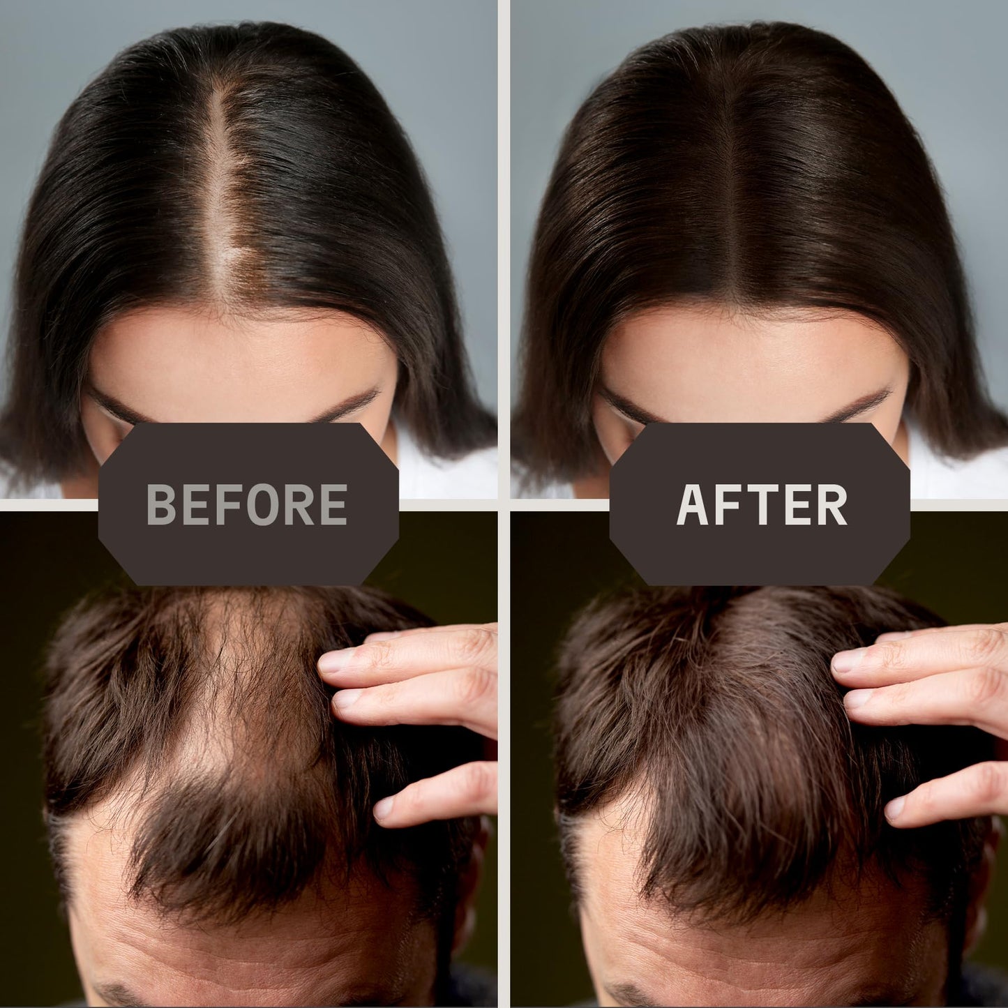 Striking Viking Hair Fibers for Thinning Hair (Medium Brown) 28g - Naturally Derived - Long Lasting Powder, Undetectable, Thicker Look for Men & Women