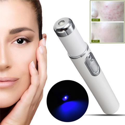 Blue Light Therapy Acne Pen