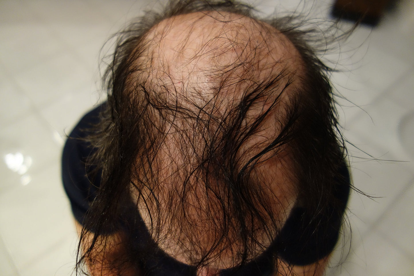 Finally Hair Keratin Hair Building Fibers for Hair Thickening Fiber Hair Loss Concealer. (Dark Grey & Pepper)