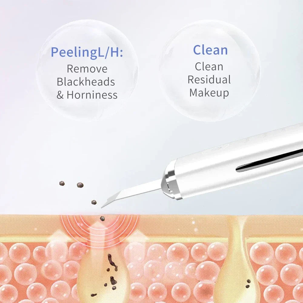 Ultrasonic Facial Skin Scrubber Cleanser