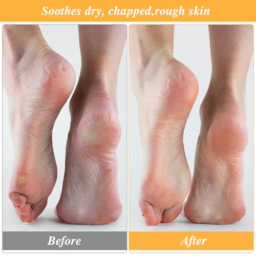 5 Pairs Foot Moisturizer Socks, Moisturizing Socks Overnight, Cotton Spa Socks for Cracked Heel Repair, Gel Spa Moisturizing Socks for Women and Men, White