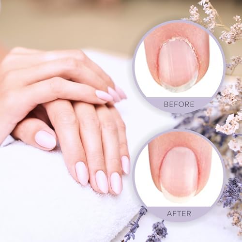 C CARE Pomegranate and Fig Roll-On Cuticle Oil | Natural Revitalizing Hydrating Nail Oil | Repaires Cuticles Overnight | Remedy For Damaged Skin And Thin Nails | Paraben Cruelty Free Formula | 10ml