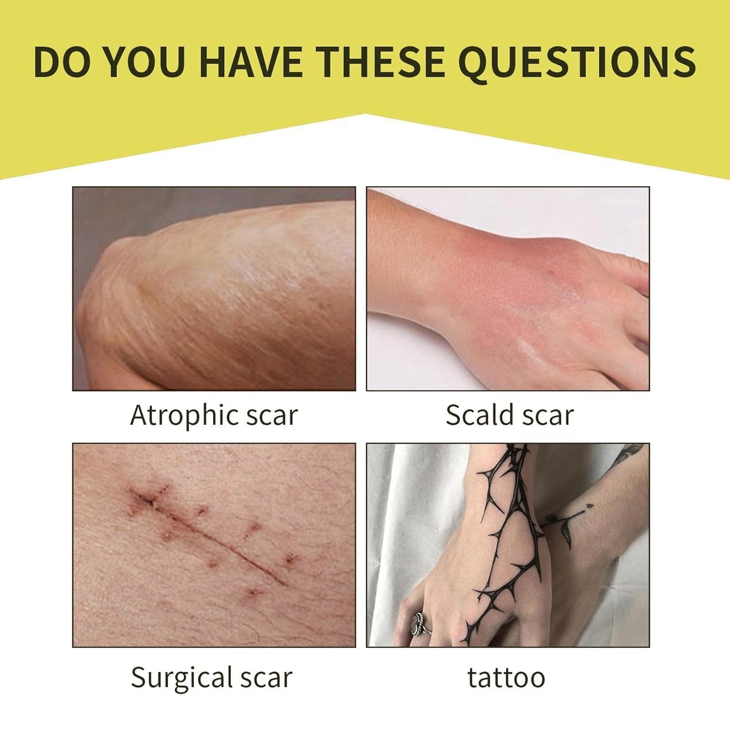 Tattoo Cover Up Patch, Tattoo Cover Up Tape, Ultra Thin Patch for Tattoo Scar and Birthmarks, Invisible Waterproof Skin Tone Concealer Sticker for Covering Up Scars Tattoos, 6 Pcs - Deep Skin