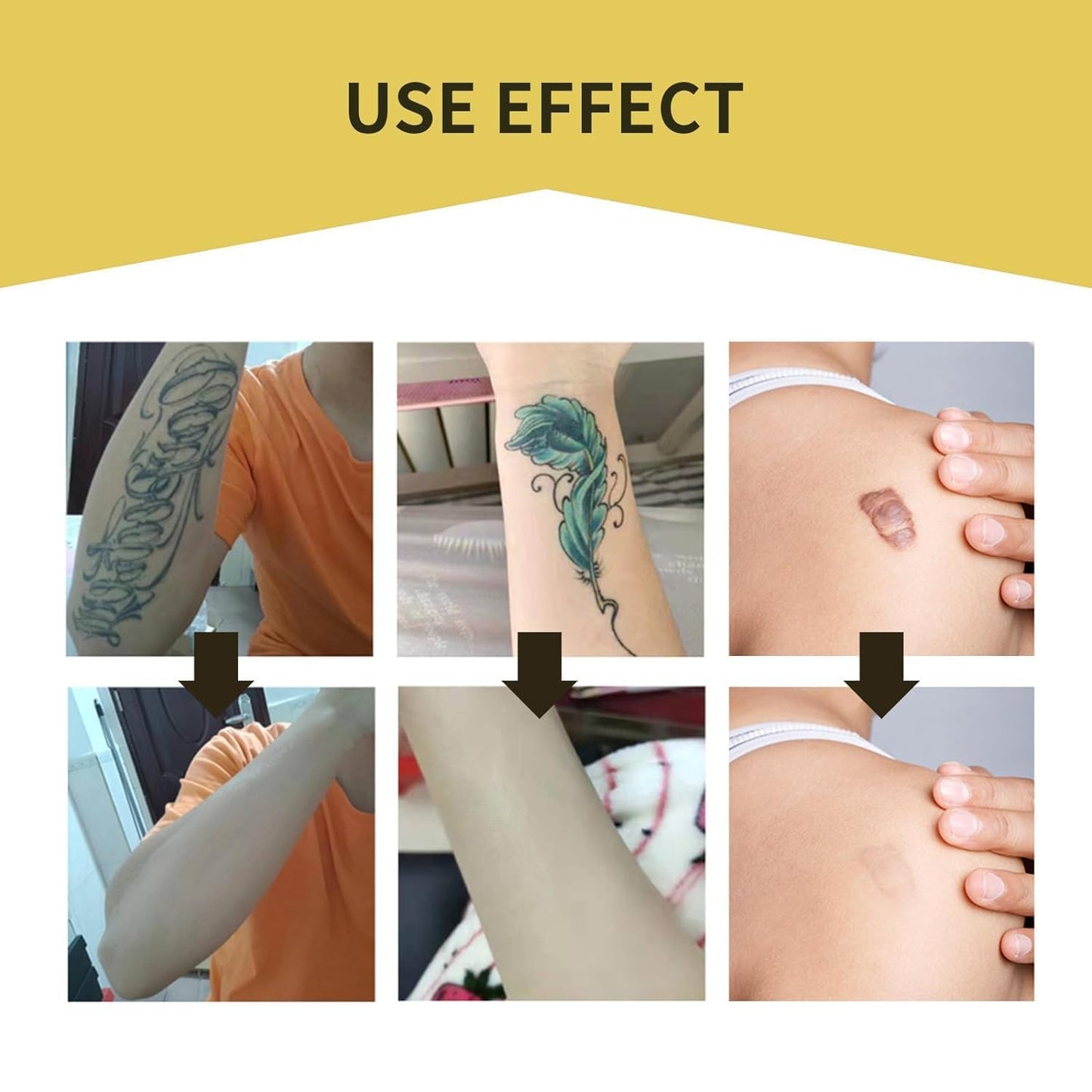 Tattoo Cover Up Patch, Tattoo Cover Up Tape, Ultra Thin Patch for Tattoo Scar and Birthmarks, Invisible Waterproof Skin Tone Concealer Sticker for Covering Up Scars Tattoos, 6 Pcs - Deep Skin