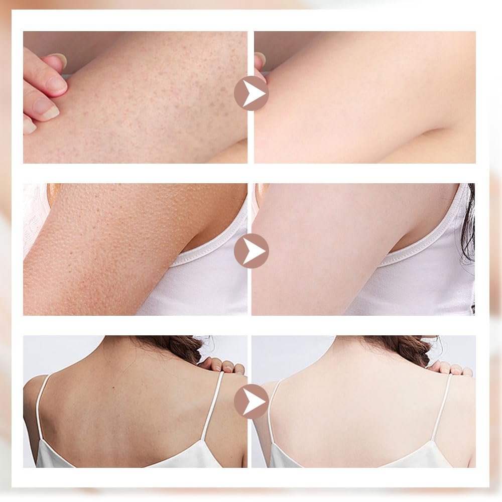 Super Soft Sunflower Suction Cup Bath Ball, 2024 Upgraded 2-in-1 Sunflower Bath Ball Exfoliating Bath Sponge Cleaning Brush, Sponge Mesh Pouf Shower Ball for Women, Men Shower (Colorful-4)