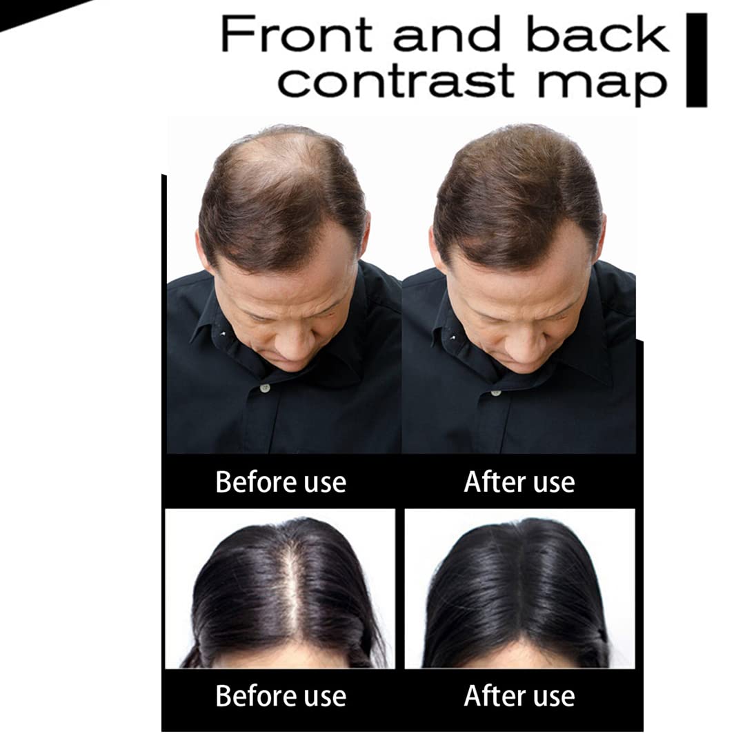 Hair Fibers Hair Building Fibers 100% Undetectable Hair Fuller Thicker,Instantly Cover Sparse Hair 25g/0.88oz (midgold)