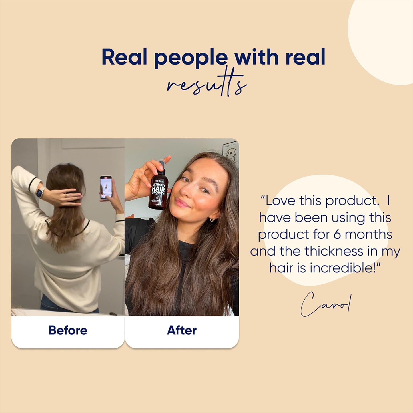 Moerie Ultimate Hair Growth Spray Designed to Strengthen & Stop Hair Loss - 100% Natural Serum for with over 100 Minerals, Vitamins & Amino acids - Fresh Scent - 5.07 Fl. Oz