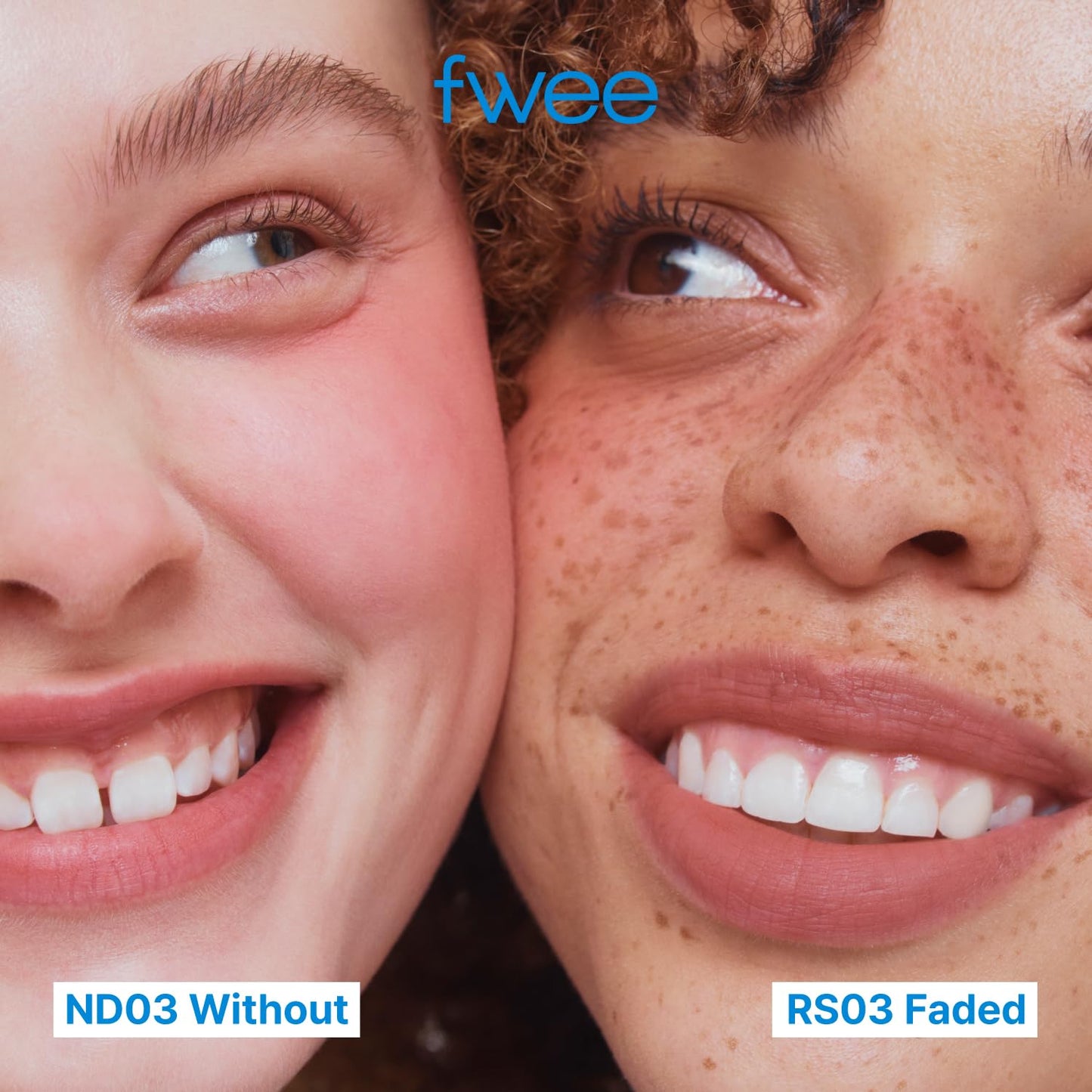 fwee Blurry Pudding Pot | Airbrushed Blush & Lip, Buildable Pigment, Long-lasting, Lightweight, Easy to Blend, Natural Soft Matte Finish - Chill’n (Rich Brown) | 0.17 oz