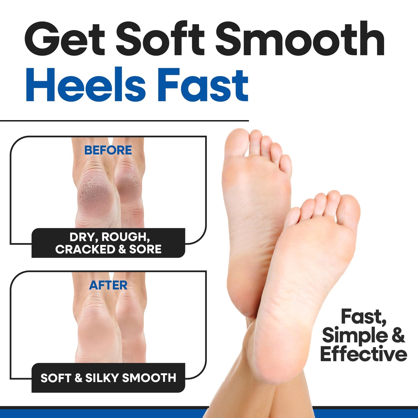 Moisturizing Socks for Women & Men | Aloe Vera Cracked Heel Treatment | Foot Callus Remover | Aloe Socks for Cracked Heels & Dry Cracked Feet | Lotion Infused Gel Heel Socks (Large - 2 Pairs)