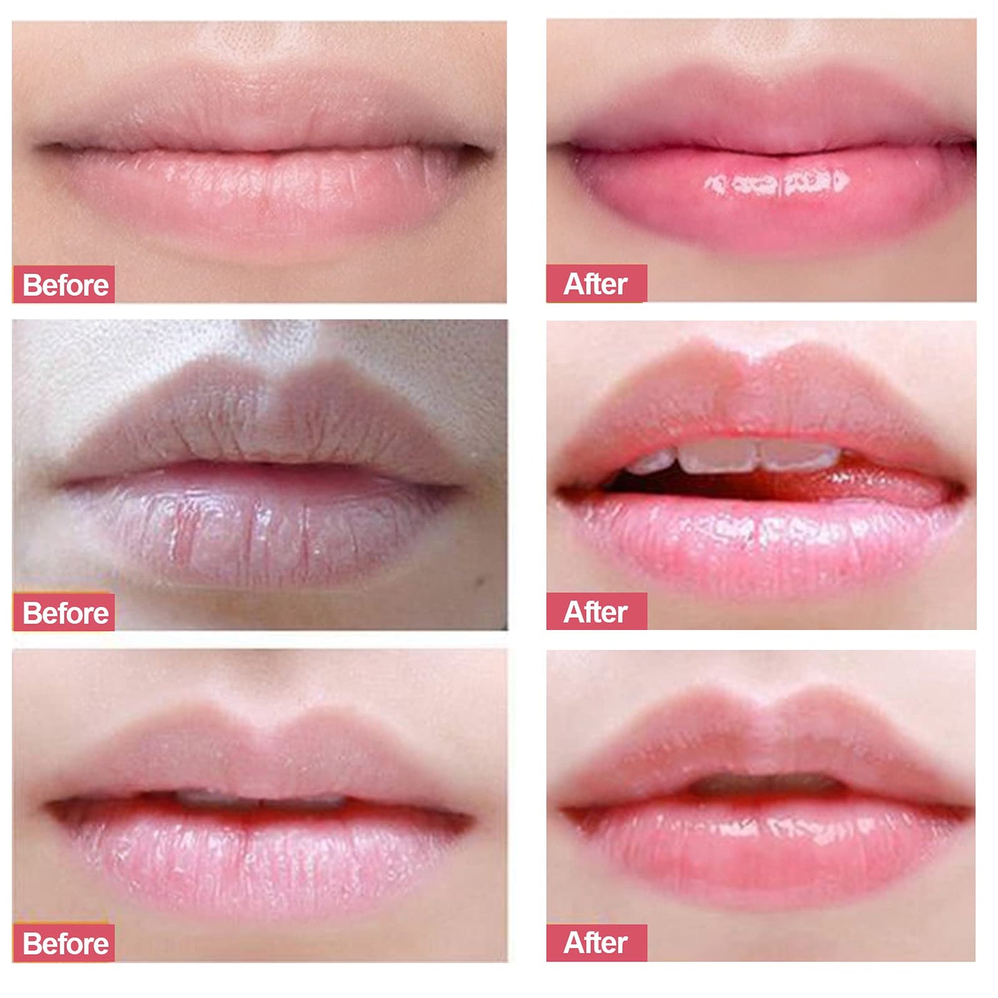 Lip Scrubs Exfoliator & Moisturizer, Lip Repair for Lush Soft Lips, Lip Moisturizer for Chapped Dry and Flaky Lips Treatment (Peach)
