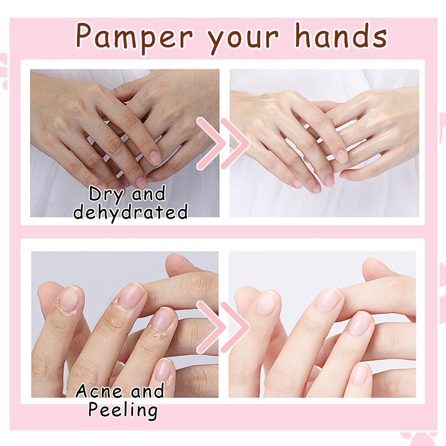 DWDiWen Hand Masks, 6 Pairs Hydrating Exfoliating Hand Peeling Mask, Smooth Hand Masks Moisturizing Gloves Overnight for Dry, Rough, Cracked Hands, Hand Skin Moisturizer Glove for Women Men（I