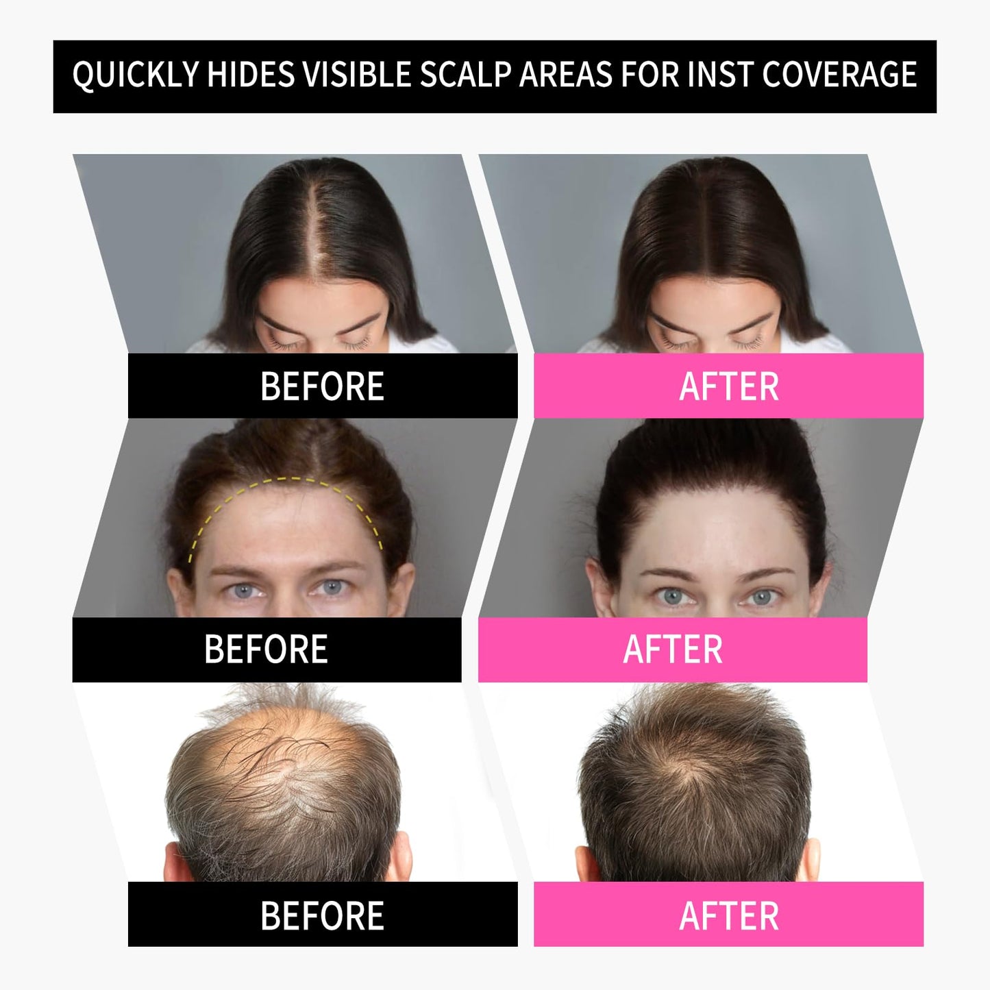 Sevich Hairline Powder 2.0, Instantly Conceals Hair Loss, Root Touch up Powder, Hair Shadow Toppers for Women & Men Thinning Gray Hair, Windproof & Sweatproof, 48H Makeup Lasting, Dark Brown