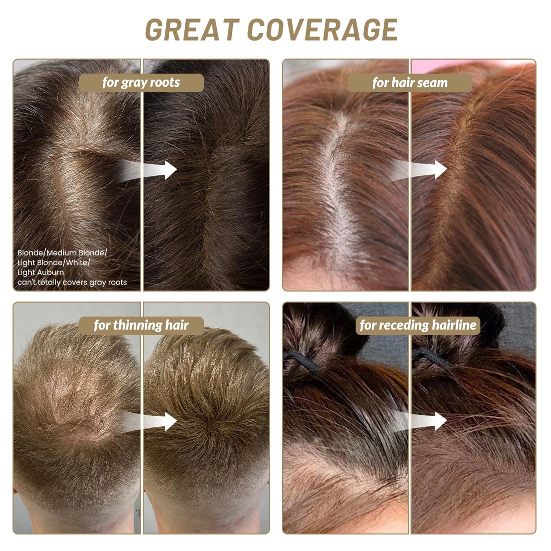 SOVONCARE Instantly Hairline Powder-Maycheer Conceals Gray Hair Loss Shadow Coverage Magic Color Root Touch Up for Women & Men Black 0.35 oz