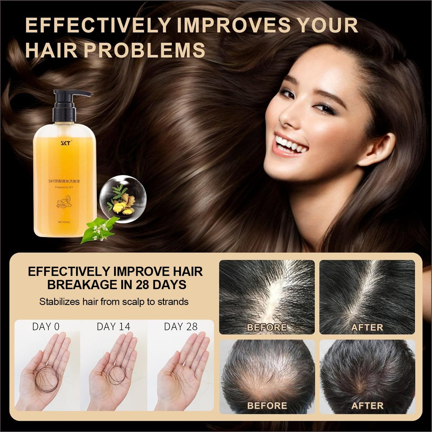 Ginger Plant Extract Anti Hair Loss Shampoo for Hair Regrowth, Thickening and Longer Hair - For Women & Men (400ML)