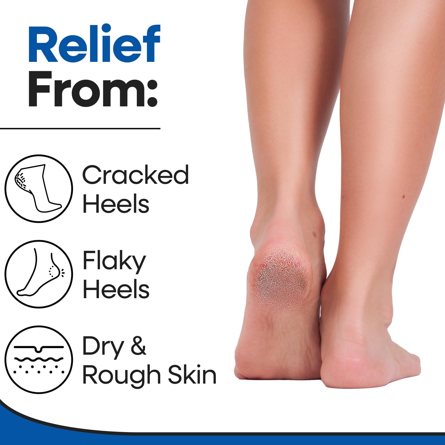 Moisturizing Socks for Women & Men | Aloe Vera Cracked Heel Treatment | Foot Callus Remover | Aloe Socks for Cracked Heels & Dry Cracked Feet | Lotion Infused Gel Heel Socks (Large - 2 Pairs)