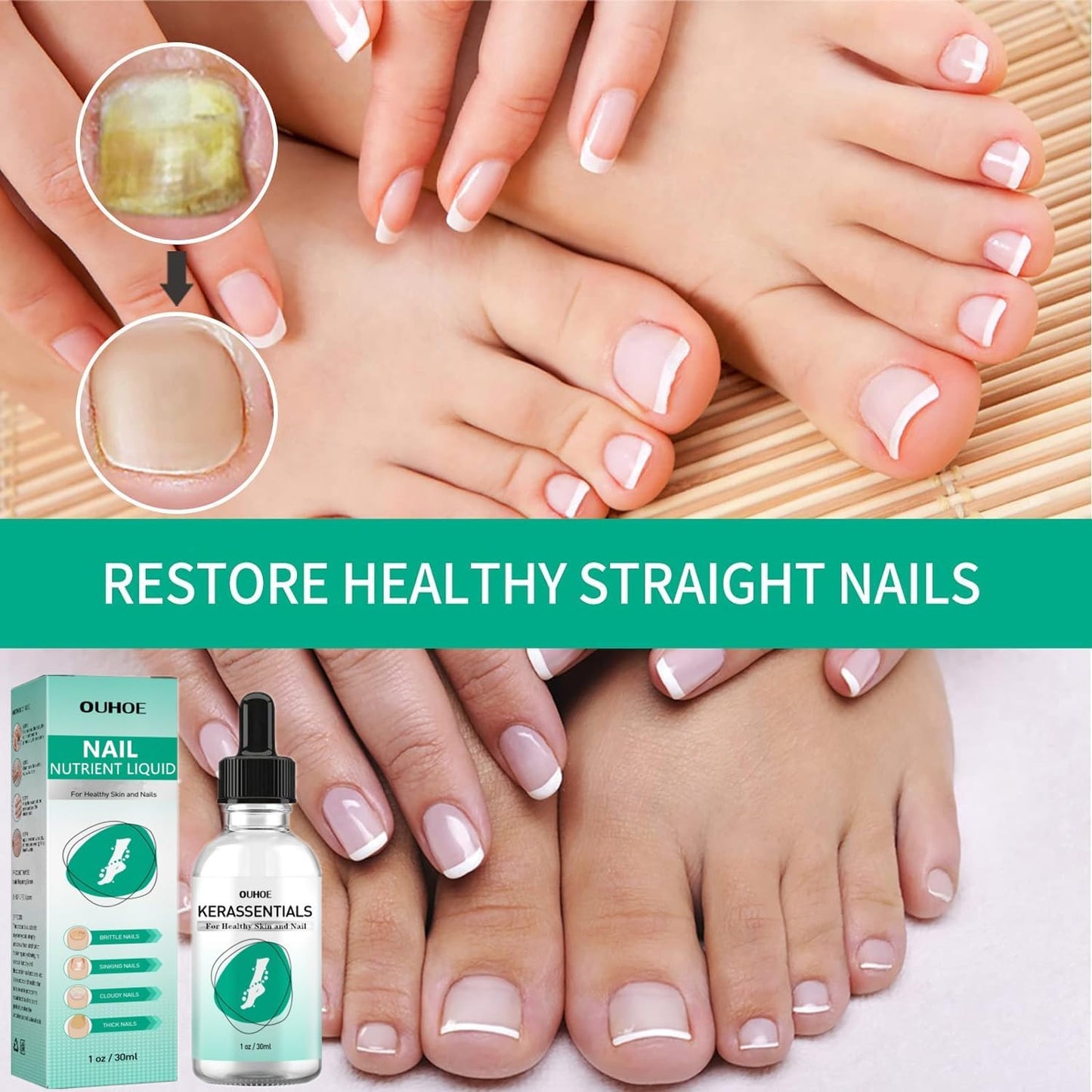 MUBSEOTH Kerassentials Toenail Oil, Kerassentials Nails Nutrient Oil, Nail Repair Solution 30ML/1PCS (4PCS)