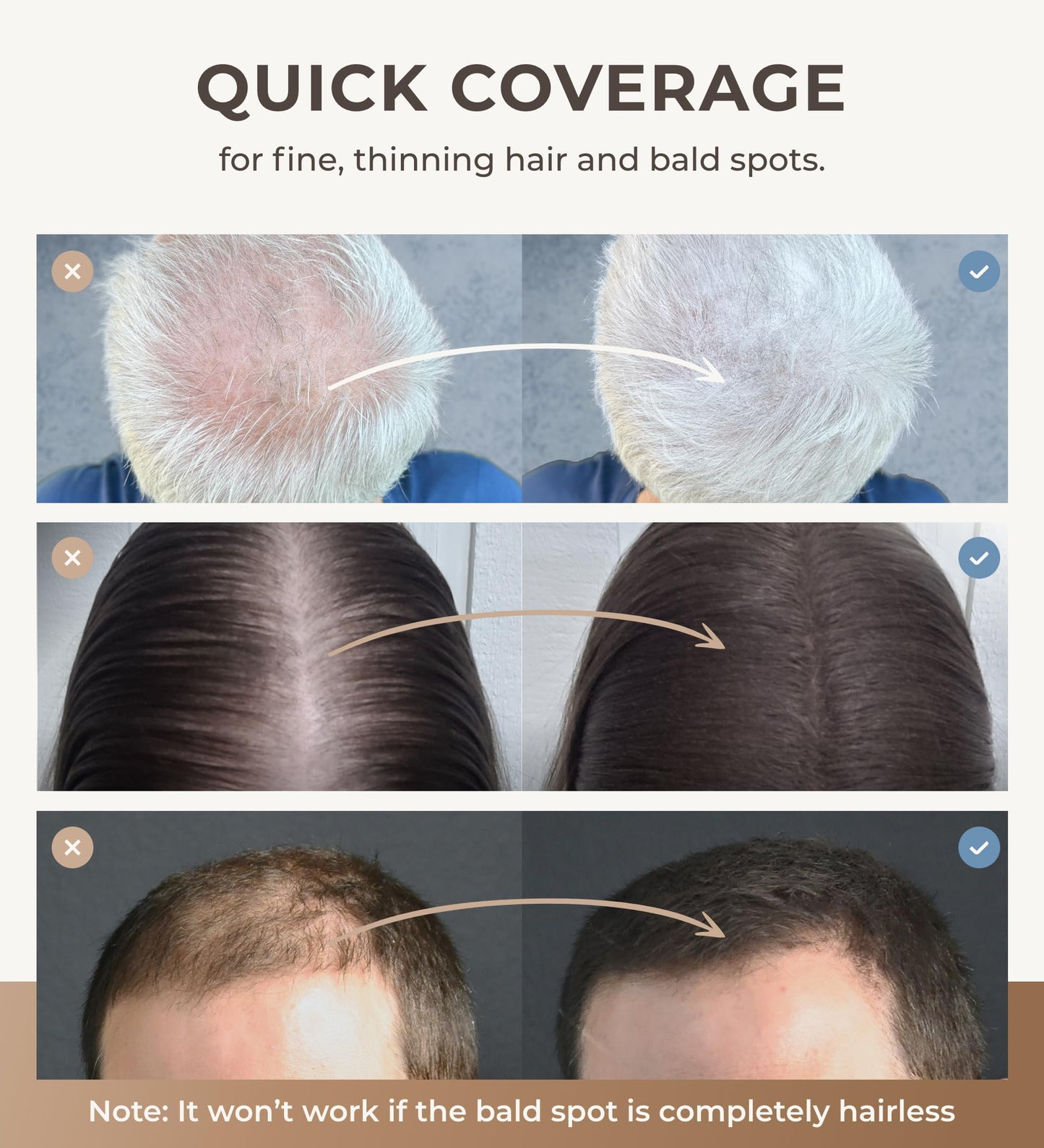 CONFIERR Keratin Hair Fibers for Men & Women - Fill In Fine or Thinning Hair, Instantly Thicker, Fuller Looking Hair (Light Brown 15g)